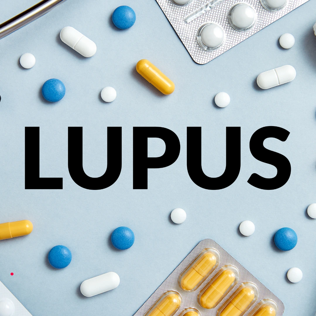 Stem Cell Therapy for lupus