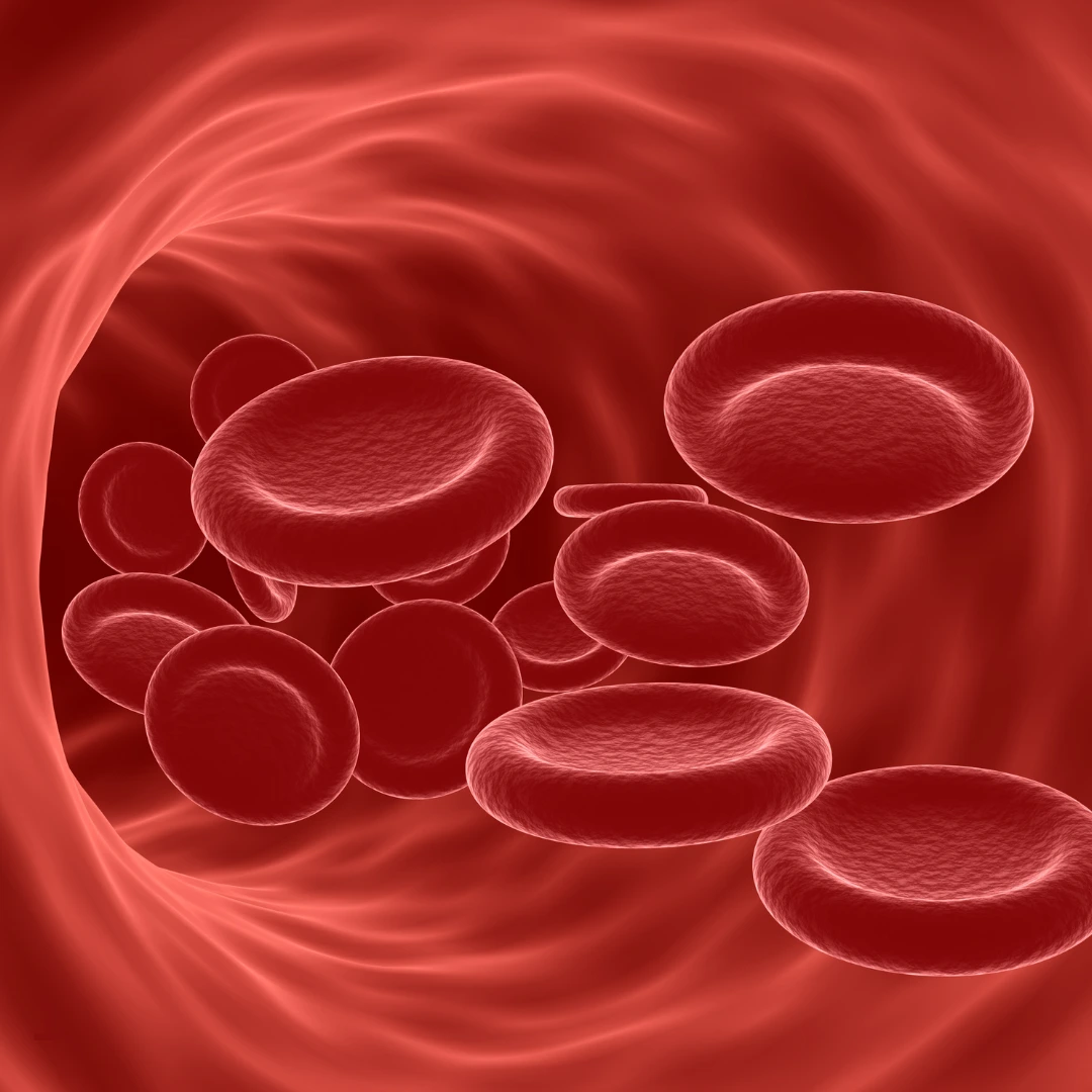sickle cell anemia
